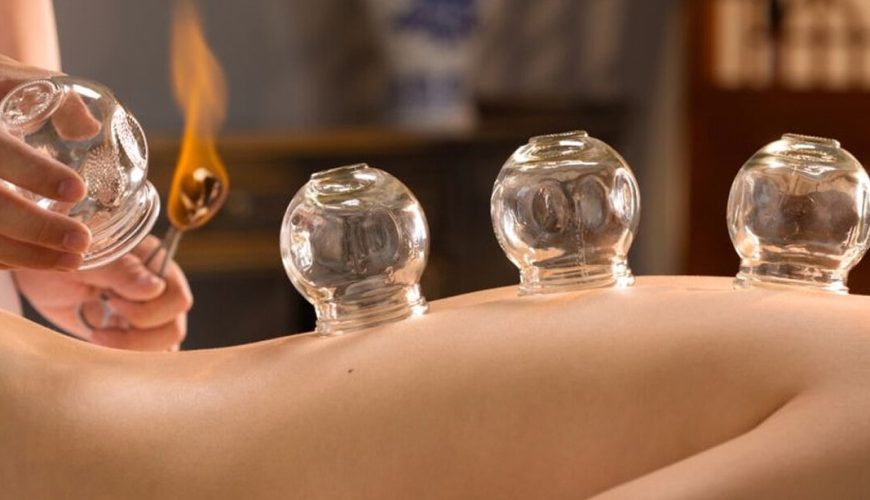 Egyptian Cupping Therapy Invigorating and Restoring through Suction Techniques