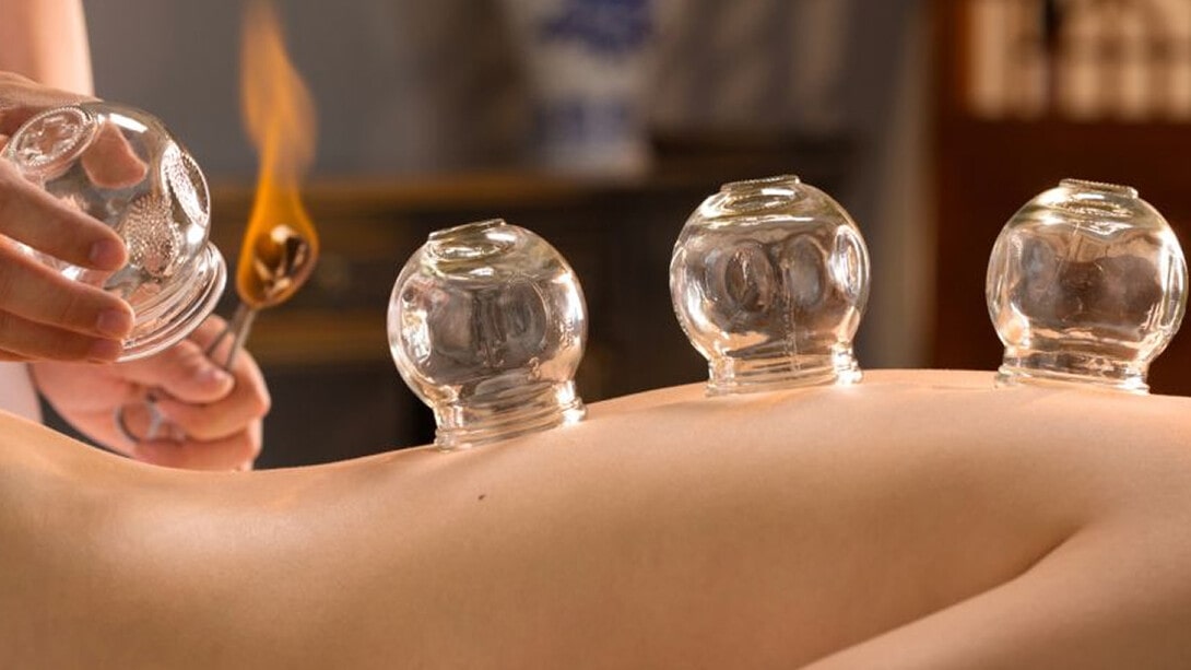 Egyptian Cupping Therapy Invigorating and Restoring through Suction Techniques